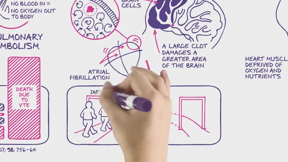 Why a Blood Clot is Serious